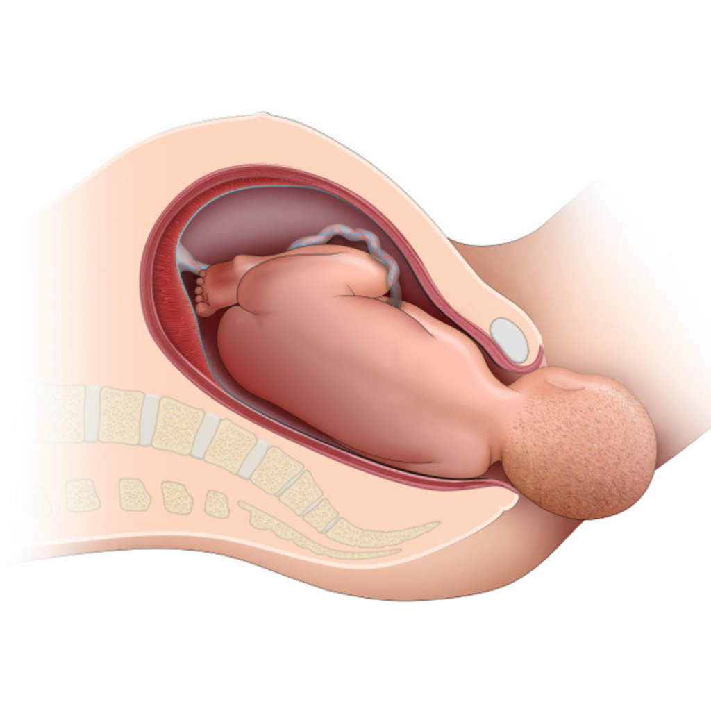 Best Gynae Hospital in kanpur