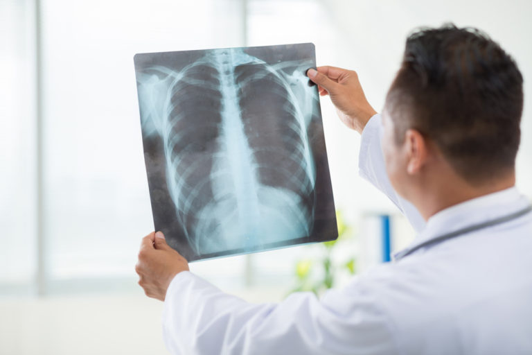 Chest Physician -Online OPD Booking