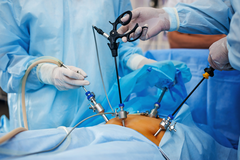 Laproscopic Surgery