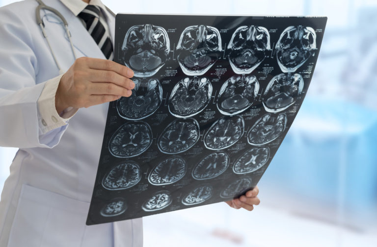 Neuro Physician -Online OPD Booking